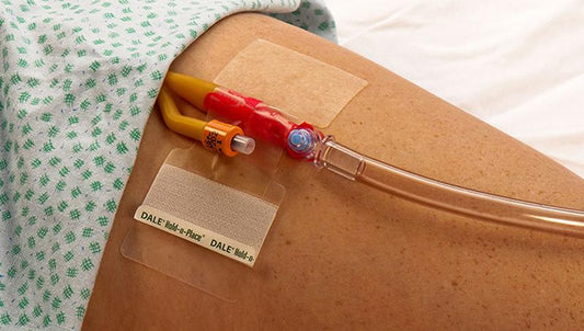 Dale Katheter fixatiepleister for catheter and urine collection, showing the adhesive strip in a medical setting.